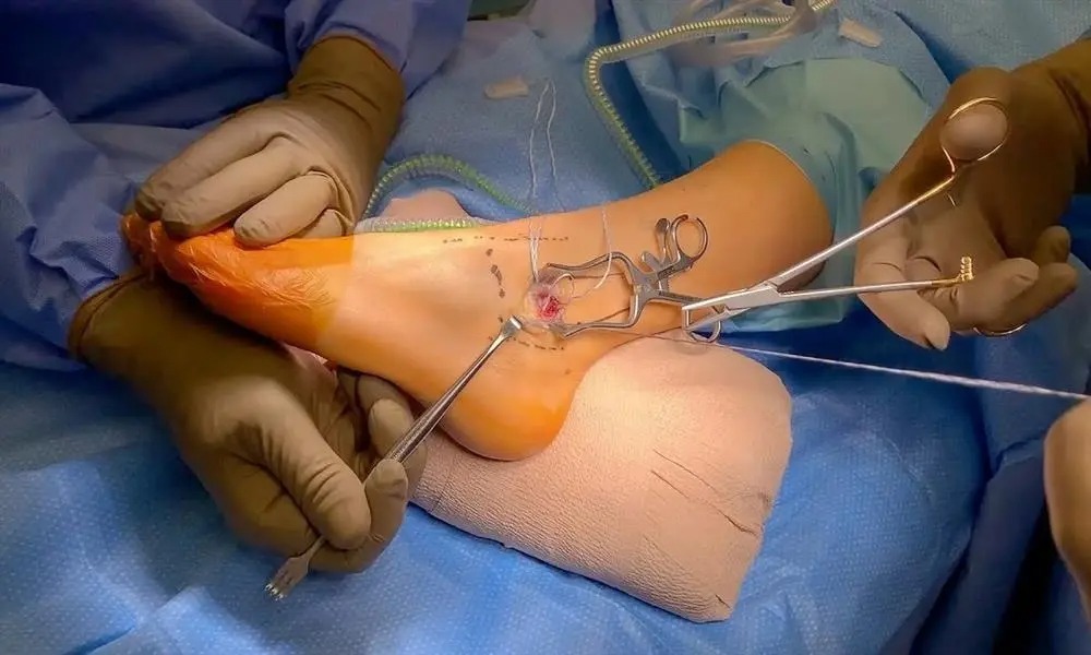 Hand Foot & Ankle Surgeon in Jaipur