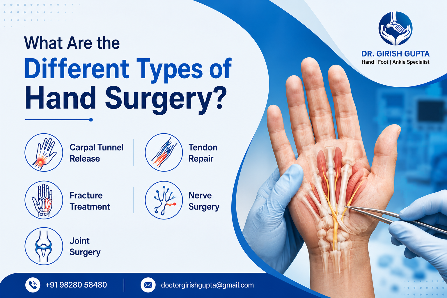 What Are the Different Types of Hand Surgery?
